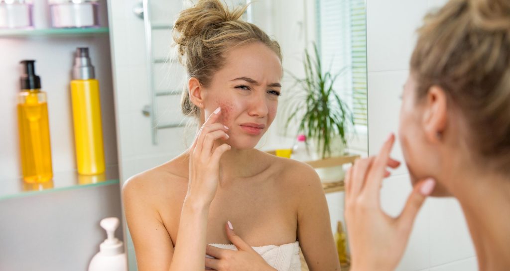 woman looking in mirror at acne breakout