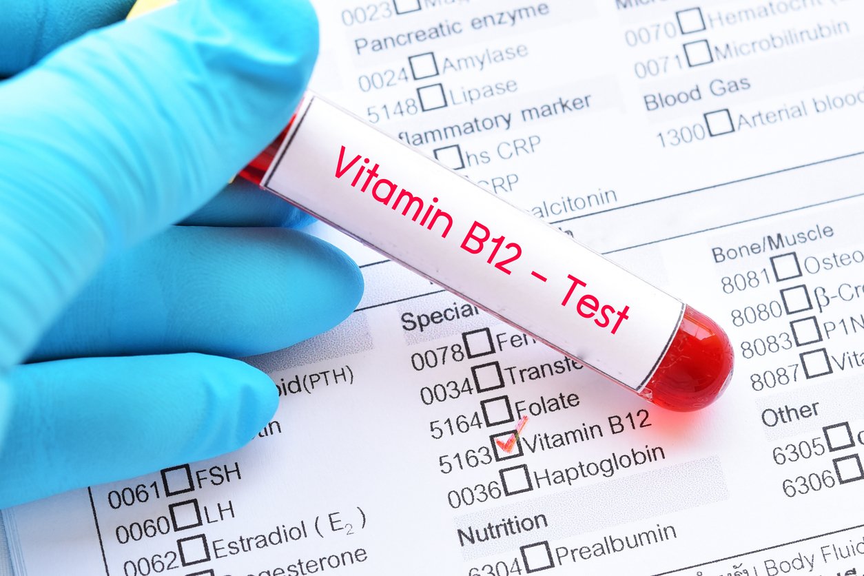 Blood sample tube with laboratory requisition form for vitamin B12 test