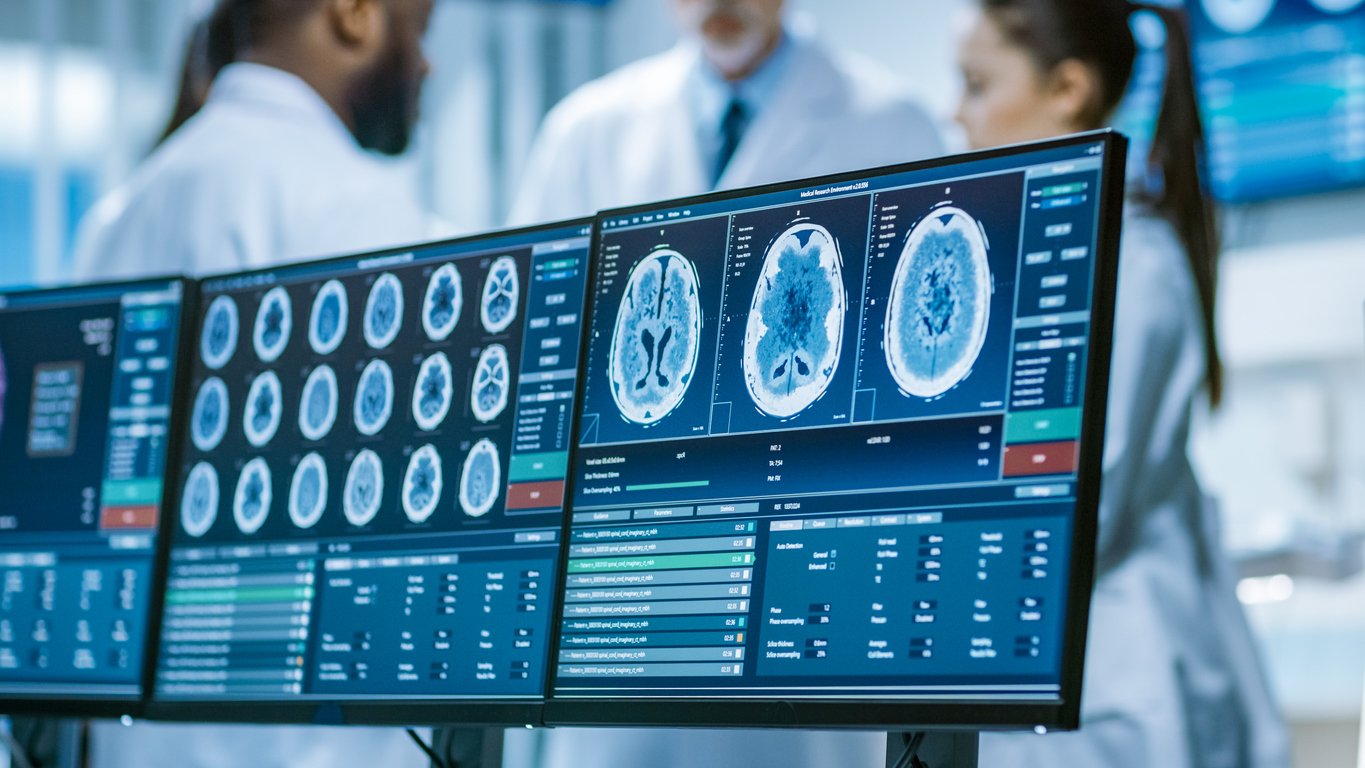 Computer Screen Showing MRI, CT Image Scan of the Brain. In the Background Meeting of the Team of Medical Scientists in the Brain Research Laboratory. Neurologists / Neuroscientists Having Analytical Discussion.