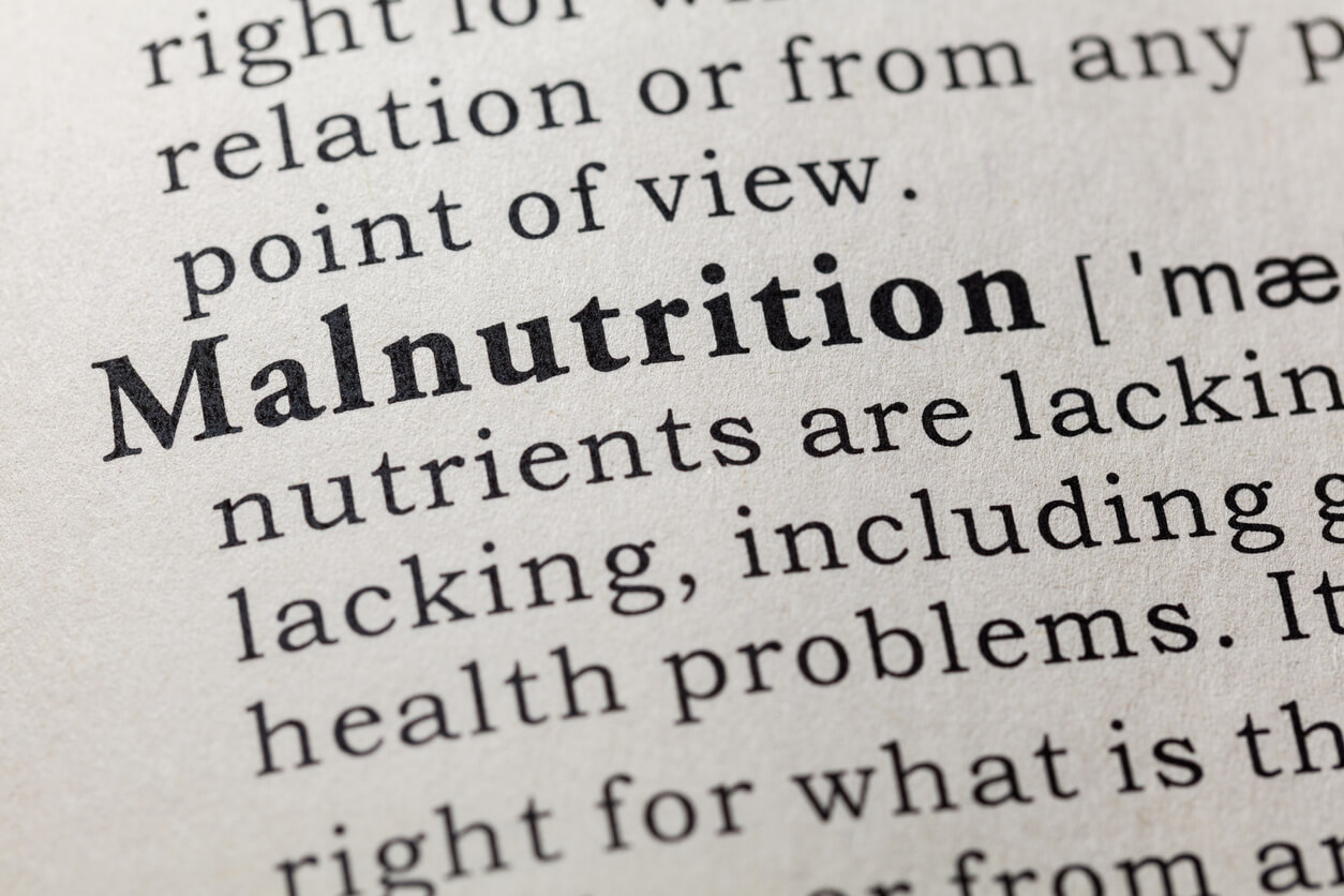 definition of malnutrition 
