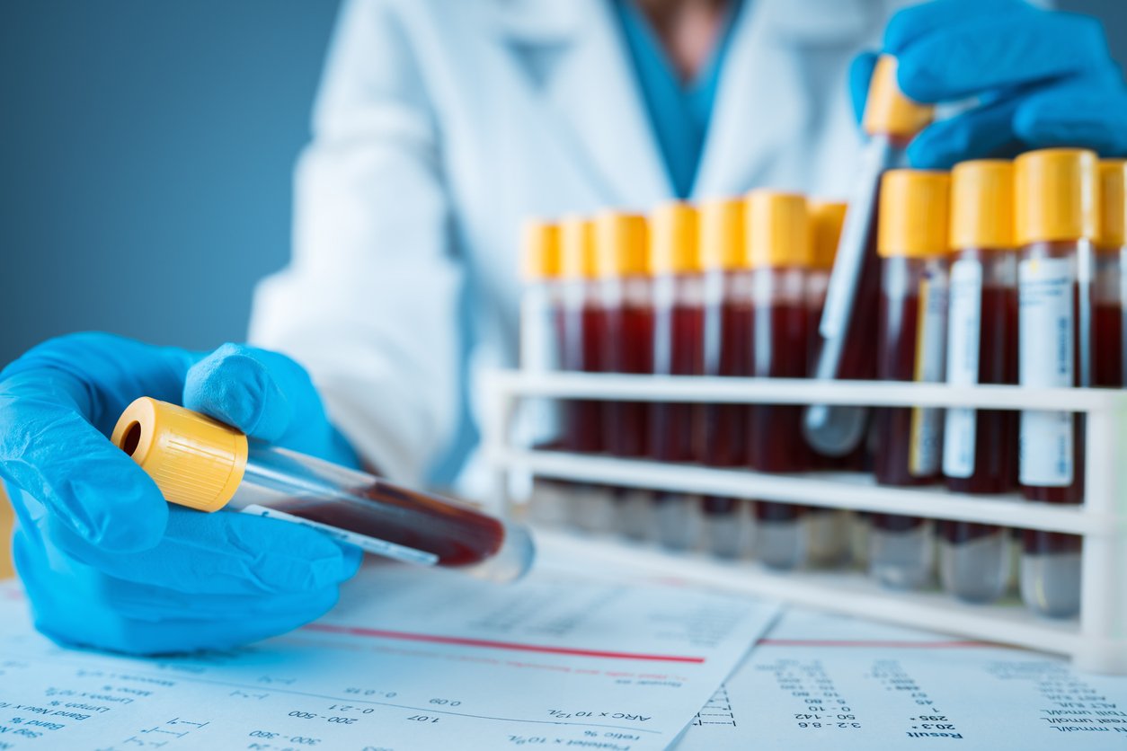 laboratory result with blood tubes