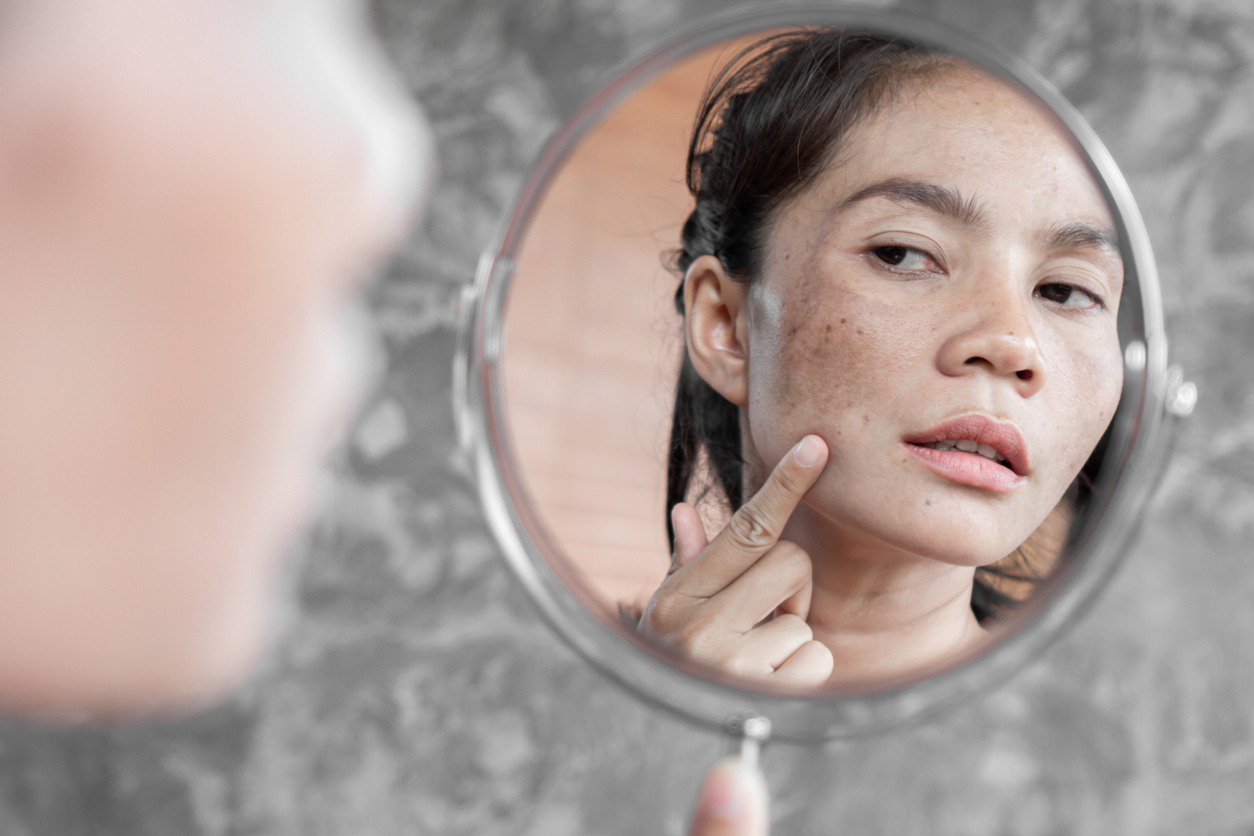 Asian woman having skin problem checking her face with dark spot, freckle from uv light in mirror