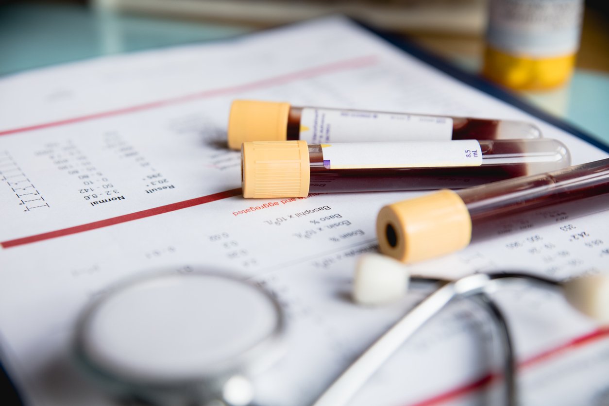 blood test tubes on lab test results