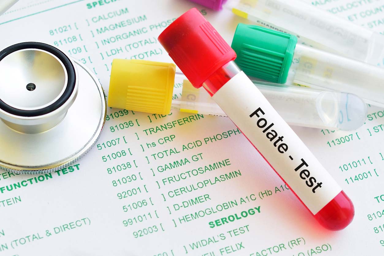 test tube for folate blood test